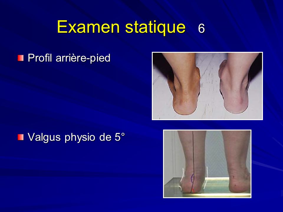 Examen clinique de la cheville et du pied ppt video online